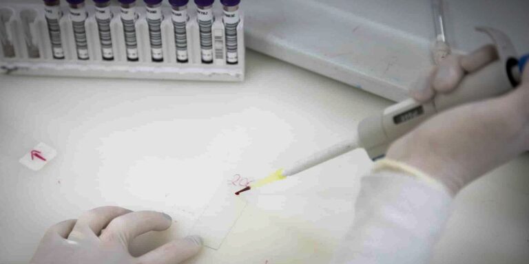 Exames descartam ebola em imigrante da República Democrática do Congo